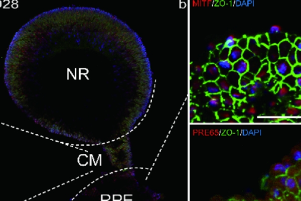 陈建苏、唐仕波团队最新研究成果：​视网膜类器官长期培养及应用